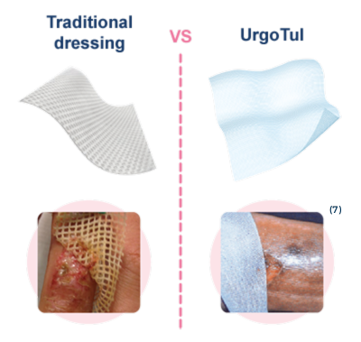 Urgotul UrgoTul Dressing 10x10cm new Health Nutrition Medical Urgotul UrgoTul Dressing 10x10cm new Health Nutrition Medical